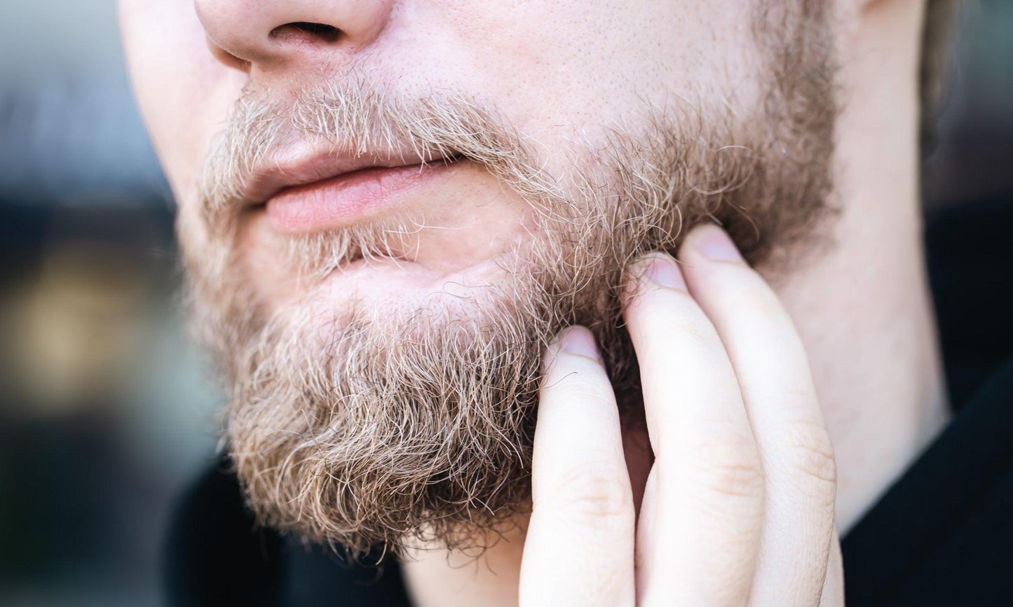 Can a beard get dandruff? - South Beach Beard